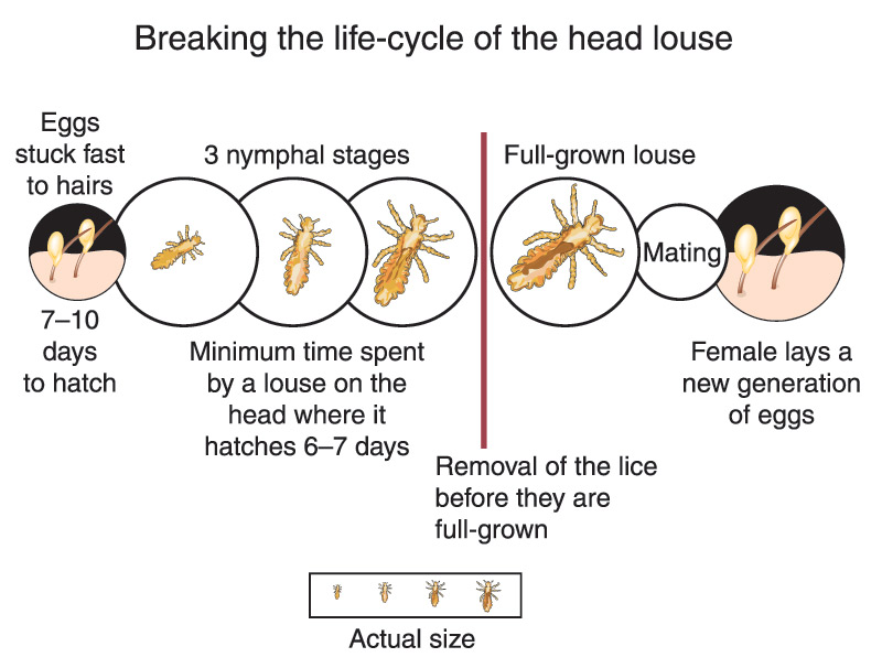 Parents scratching their heads at school district's lice policy East